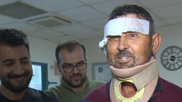 Antalya'da 'aslan döven adam' taburcu oldu olay açıklamasını yaptı; Sivrisinekler ısırmasın diye üstümü örttüm, aslan ısırdı
