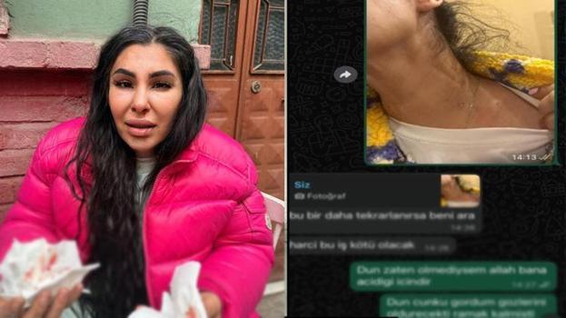 Ayrılmak istediği sevgilisi hayatını kabusa çevirdi! Evini basıp darbetti: 'Ölmek istemiyorum'