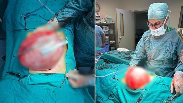 Bolu'da fazla kilolarından kurtulmak isteyen liseli genç karnından çıkanlarla şaşkına döndü