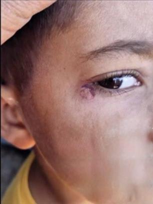 Öğrencinin yüzünde sigara söndüren temizlikçi tutuklandı