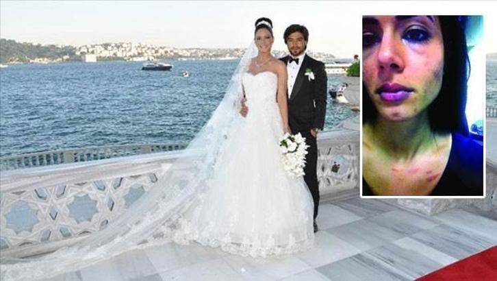İbrahim Toraman eşini böyle dövmüş
