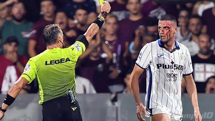 Merih Demiral kanlar içinde! Gören kahroldu