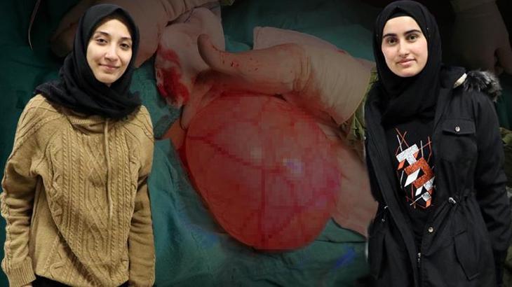 Doktorlar bile inanamadı! Herkes hamile sanıyordu gerçek baÅŸka çıktı