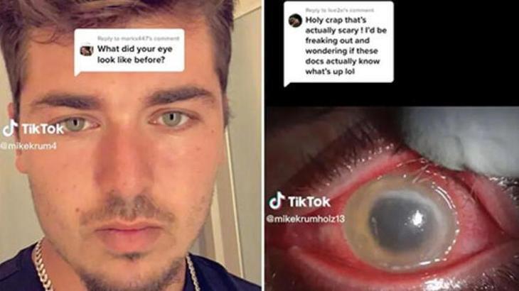 Lens ile uyudu, hayatı kabusa döndü
