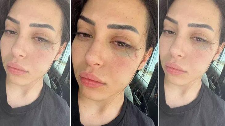 Güney Kıbrıs Rum Kesimi’nde saldırıya uğrayan Asya Karaali’nin duruşması 6 Temmuz’da yapılacak