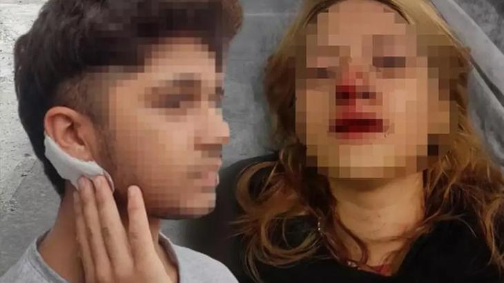 İstanbul'da sokakta vahÅŸet! Genç kızın yüzüne taÅŸla vurdular, arkadaşının kulağını kestiler