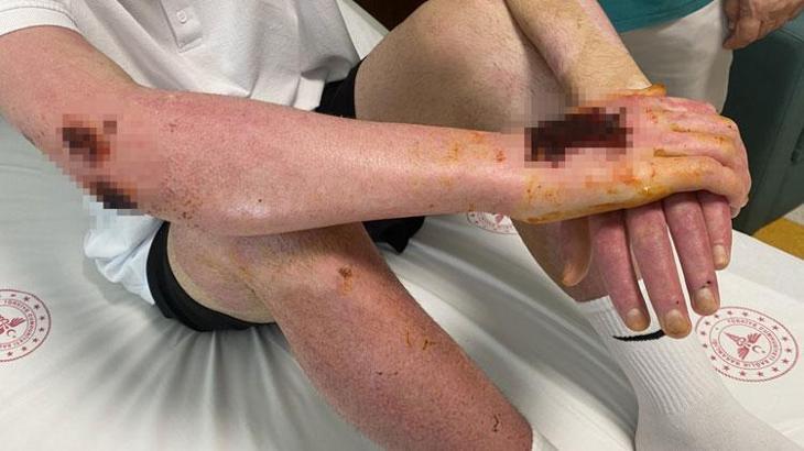 Araçta seyir halindeyken sıktığı deodorantı sonları oluyordu!