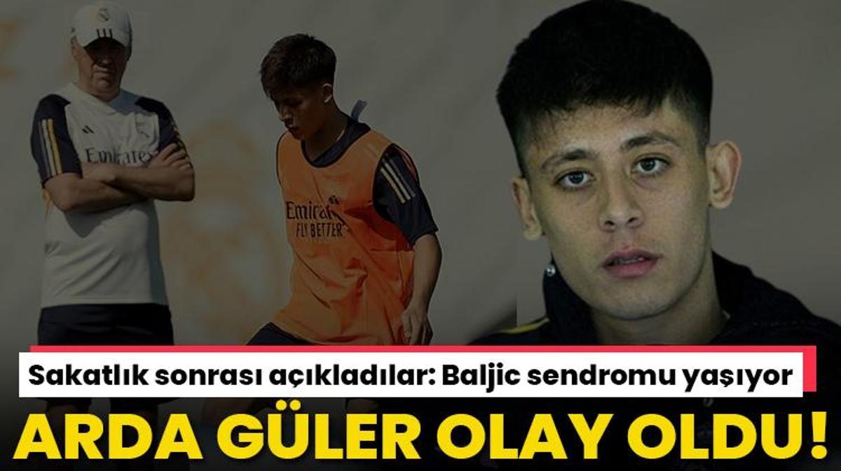 Real Madrid De Arda G Ler Depremi Yine Olay Oldu Sakatl K Sonras Patlad Baljic Sendromu