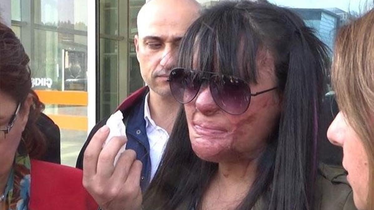 Sevgilisinin yüzüne asit döktüğü Berfin: Ozan'a hakkımı helal ettim