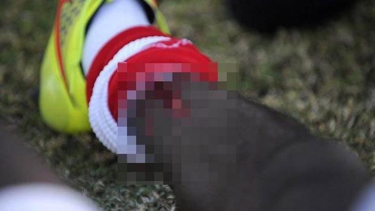 Acı içinde yerde kaldı!