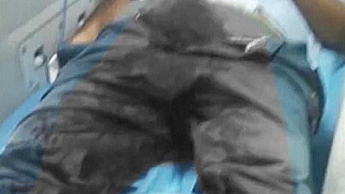 "İşe yaramıyor" deyip penisini kesti