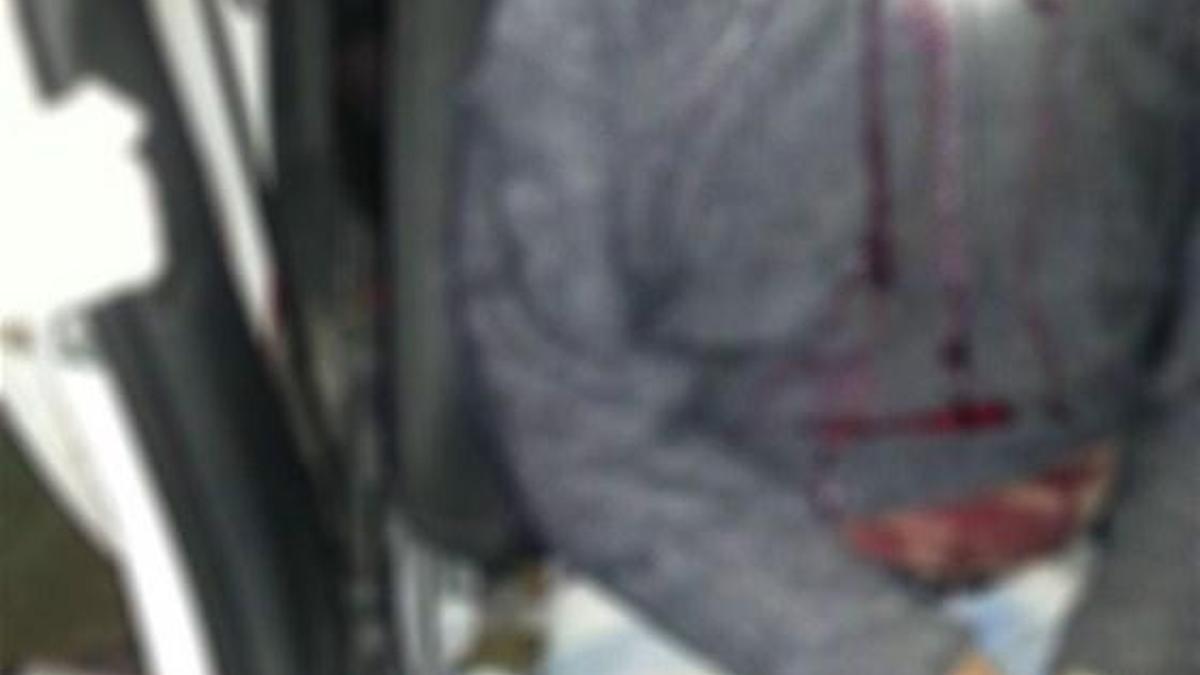 Hırsızlıktan aranan zanlının trafik kazasında başı koptu!
