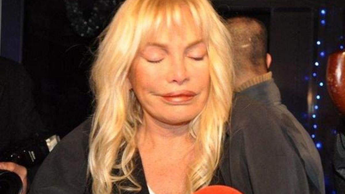 Ajda Pekkan yine yüzünü gerdirdi