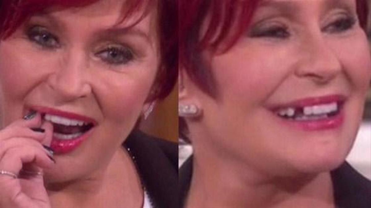 Canlı yayında dişi düştü!