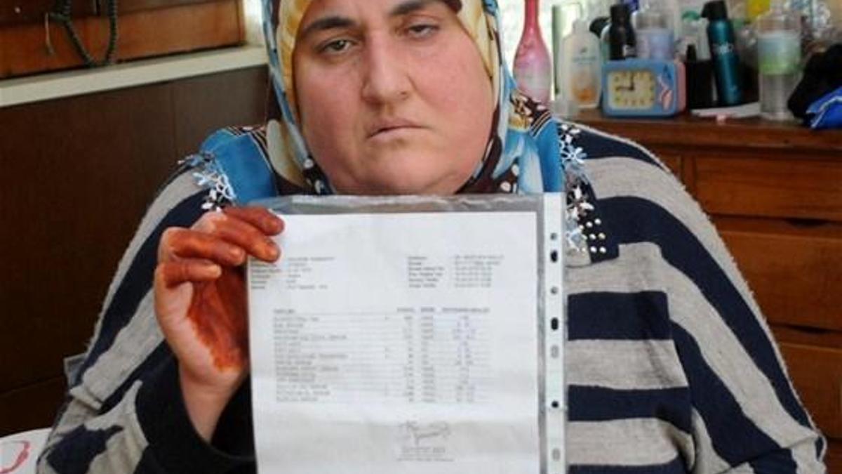 Üzüntüden yüz felci oldu