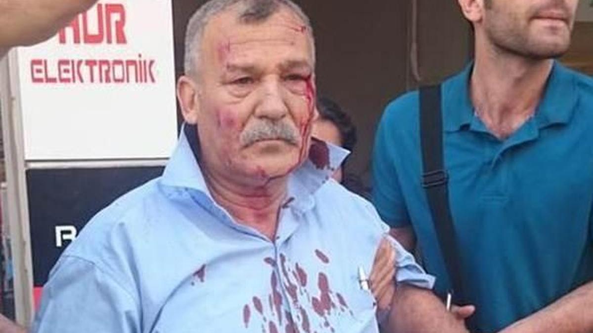 İki bombalı saldırıdan da sağ kurtuldu