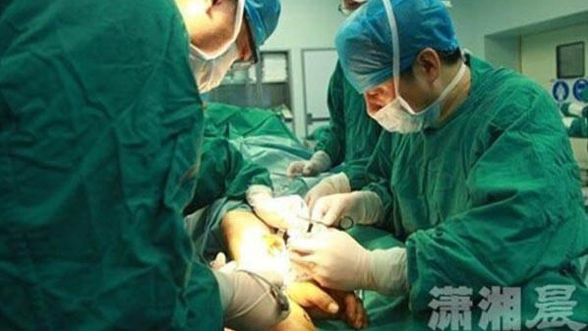 Çin'de mucize gibi operasyon: Kopan elini ayağında yaşattılar!
