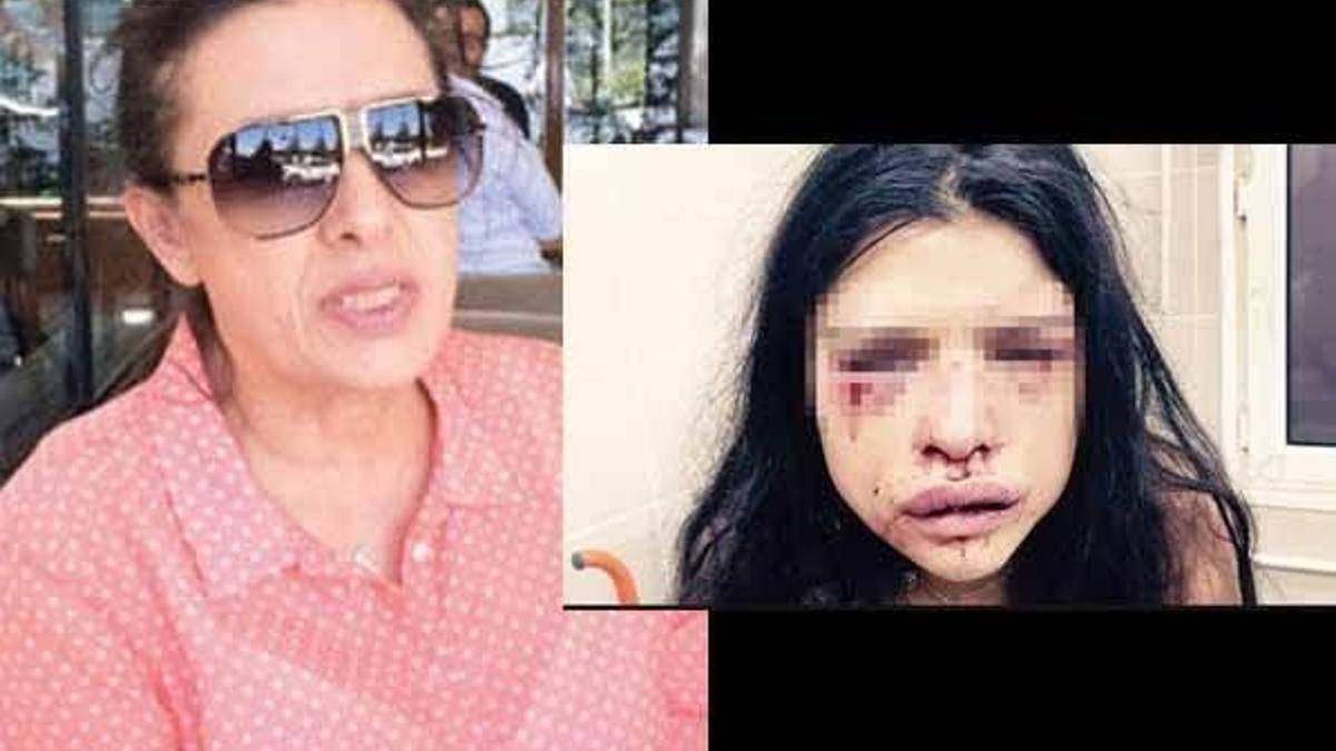 Melis Çakır’ın annesi: Onur kızımı öldürecek