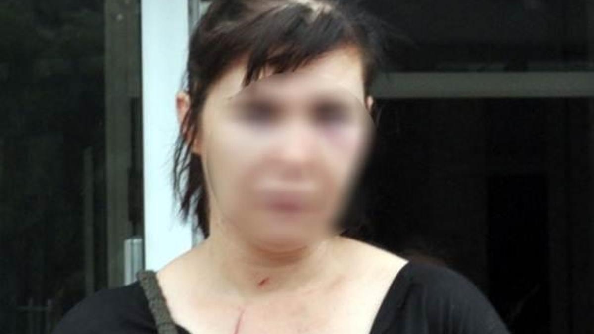 Ağabeyinin eşini bıçakladı!