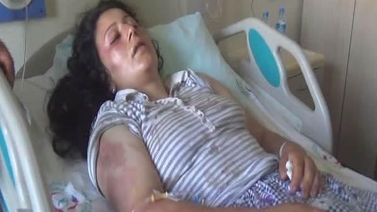 Koca şiddetine dayanamadı!