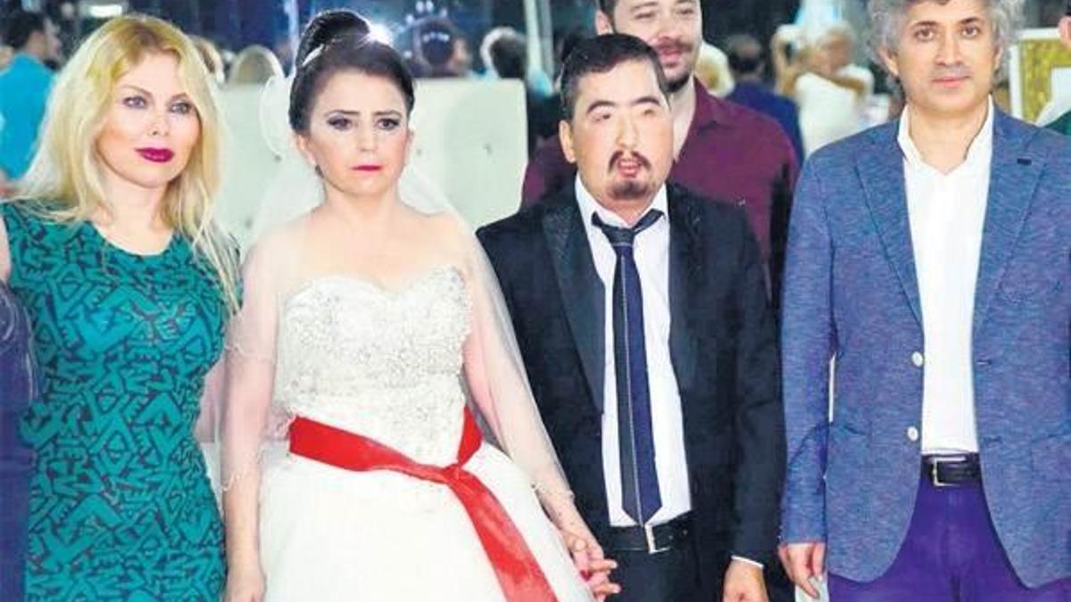 4’üncü yüz nakli yapılan Çolak, dünyaevine girdi