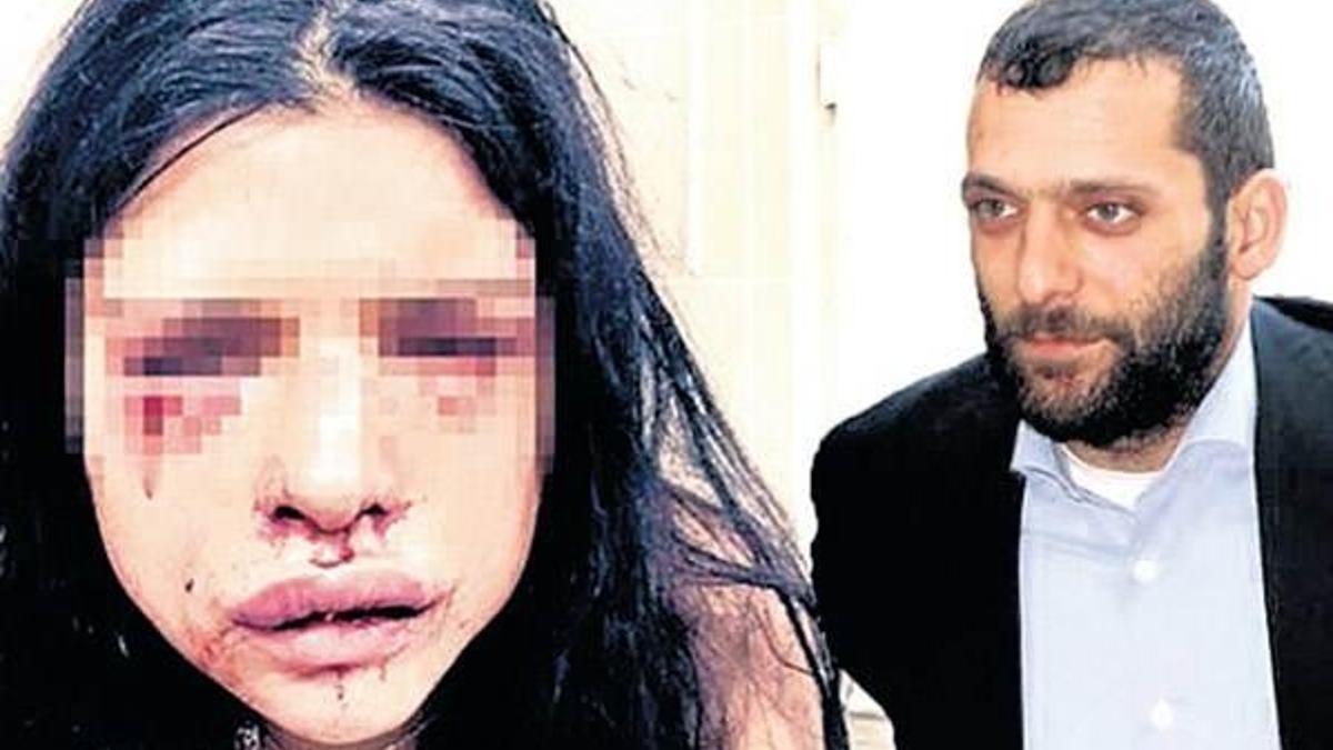 ‘Melis’e beş-altı tane vurdum o hale ben getirmedim’