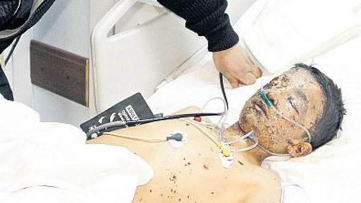 ‘Üzerime ışığımı kapattılar’