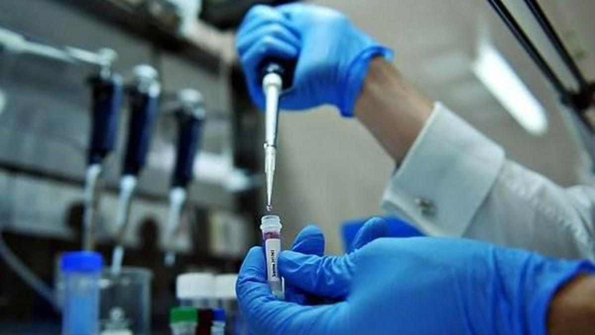 Ermenistan'da domuz gribi nedeniyle 10 kişi öldü