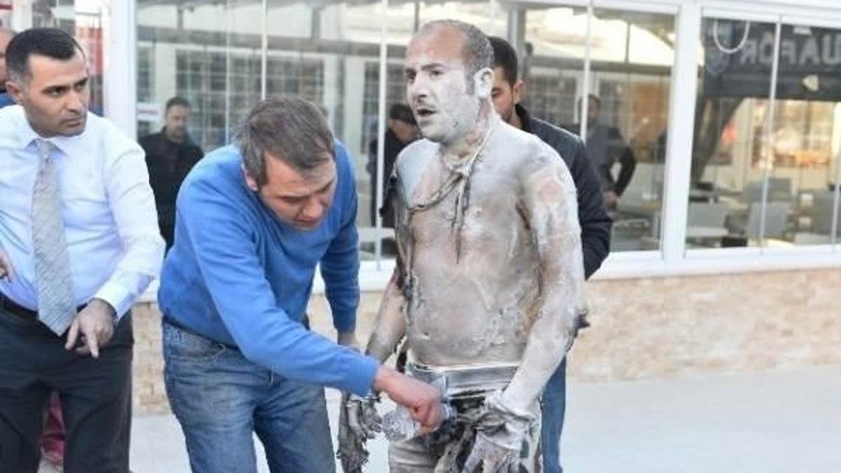 Belediye önünde kendini yakan vatandaştan acı haber