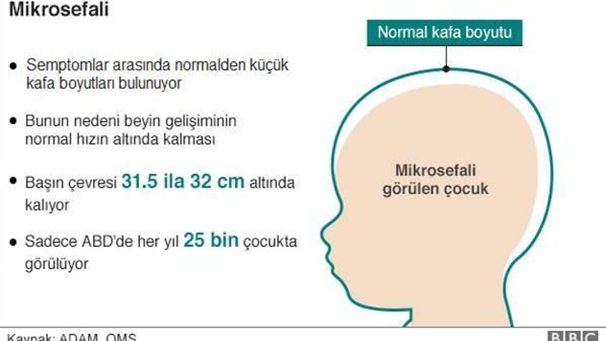 Zika virüsü: ABD'de 14 olası 'cinsel yolla bulaşma' vakası