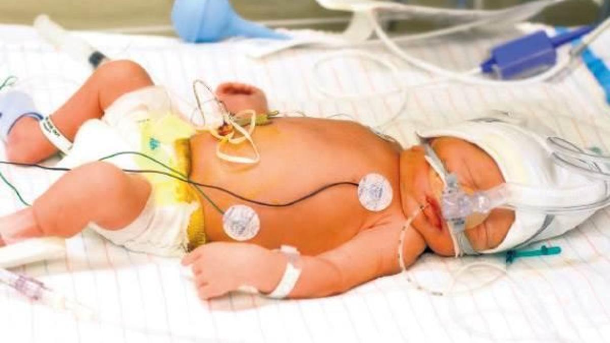 Kürtajla alınan bebek 34 haftalık çıktı