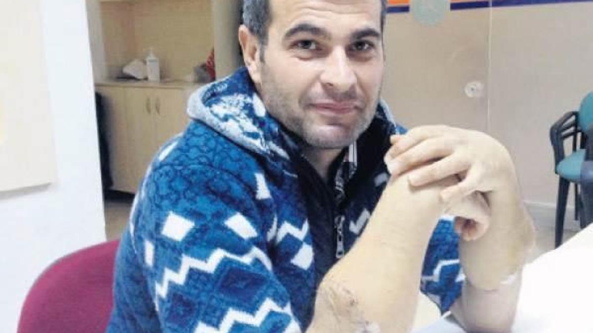 ‘Yeni kollarla mucizeyi yaşıyorum’
