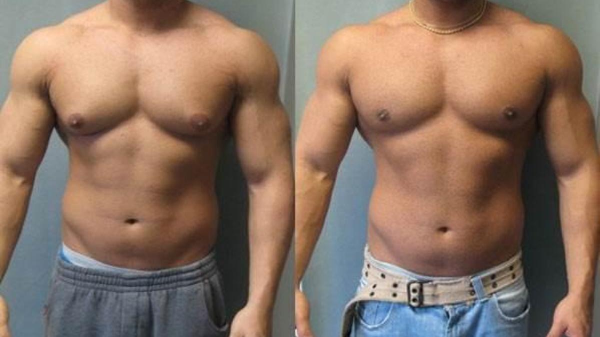 Meme büyümesi erkeklerin psikolojisini bozuyor