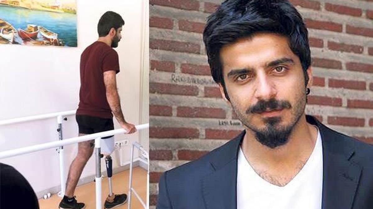 Cafer Altun protez bacağına kavuştu