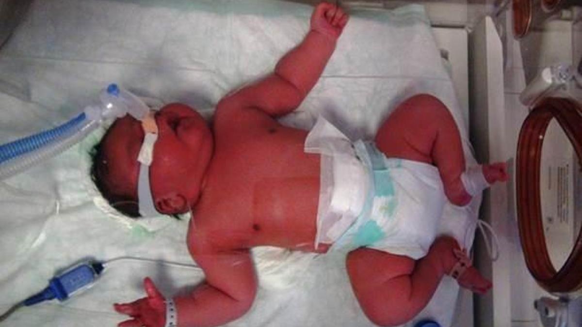 Suriyeli kadın, 5 kilo 750 gramlık bebek dünyaya getirdi