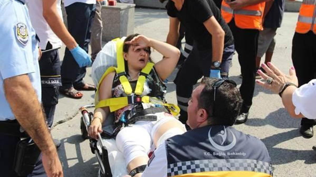 Yürüyen merdivende yerinden çıkan fırça 2 turisti yaraladı