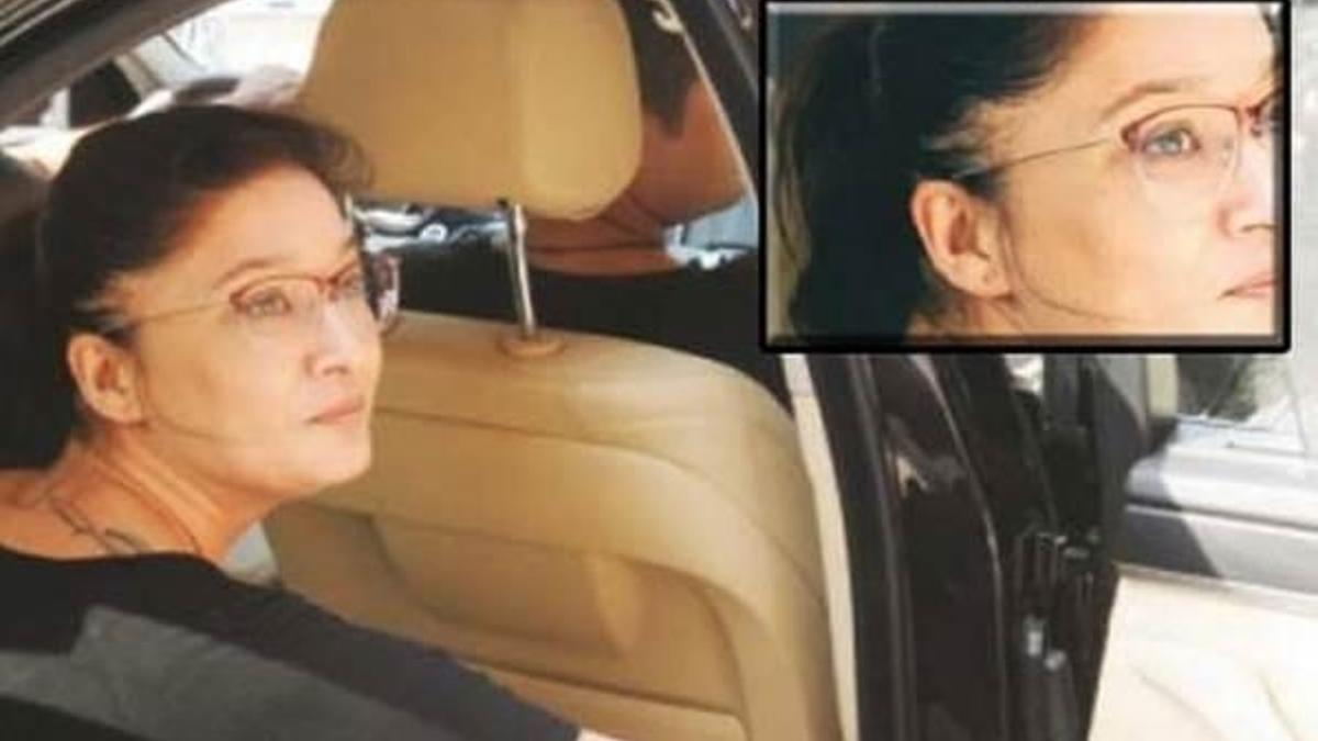 Nurgül Yeşilçay'ın saçları dökülüyor