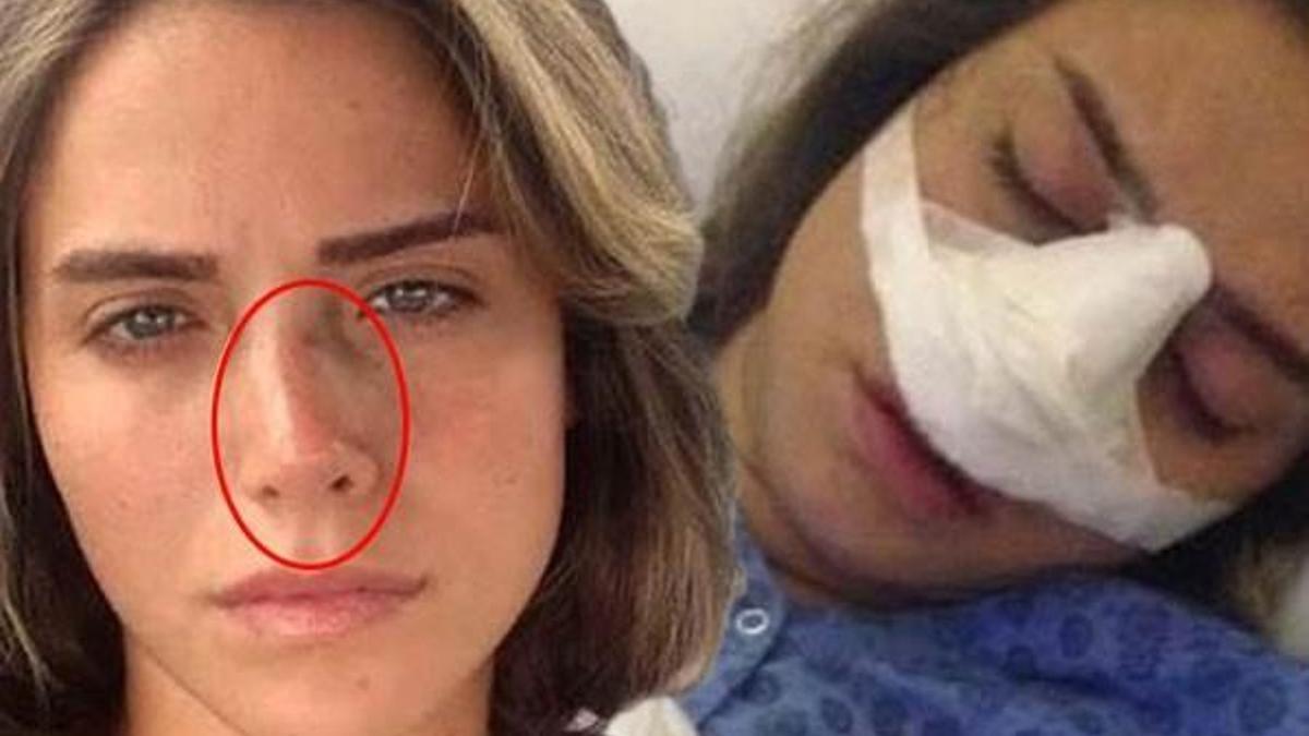 Ceyda Ateş’in burnu yamulmuş!