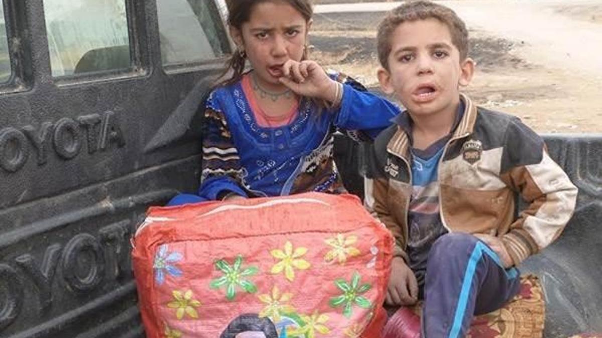 Musullu genç ABD yüzünden bacağını kaybetti