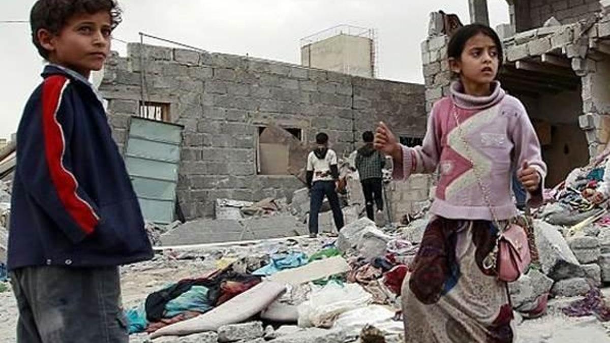 Yemenli çocuklar açlıktan hayatını kaybediyor