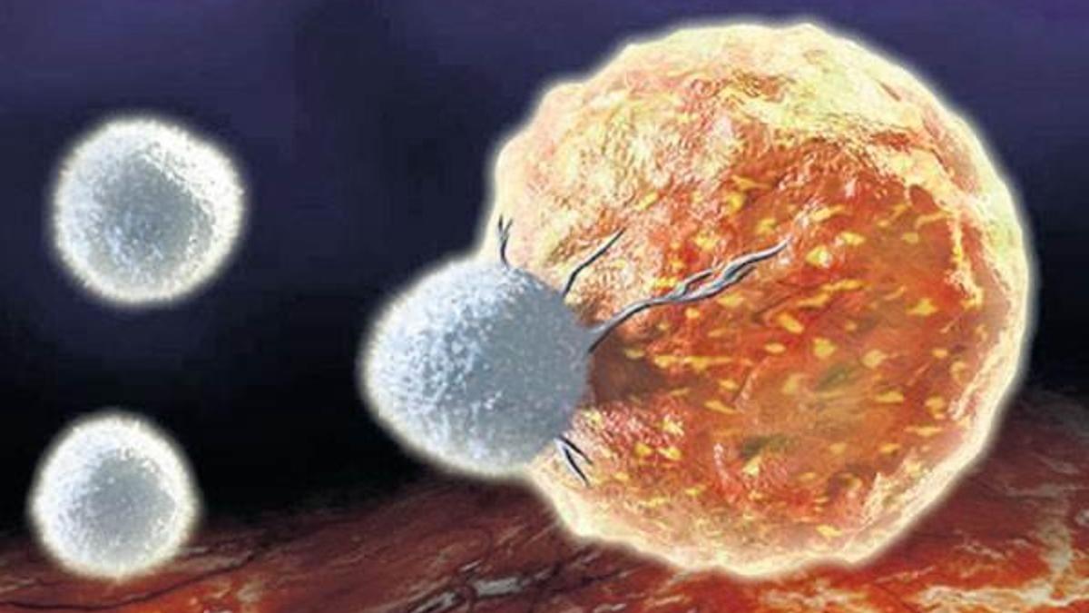 Robotik cerrahiyle kansere darbe