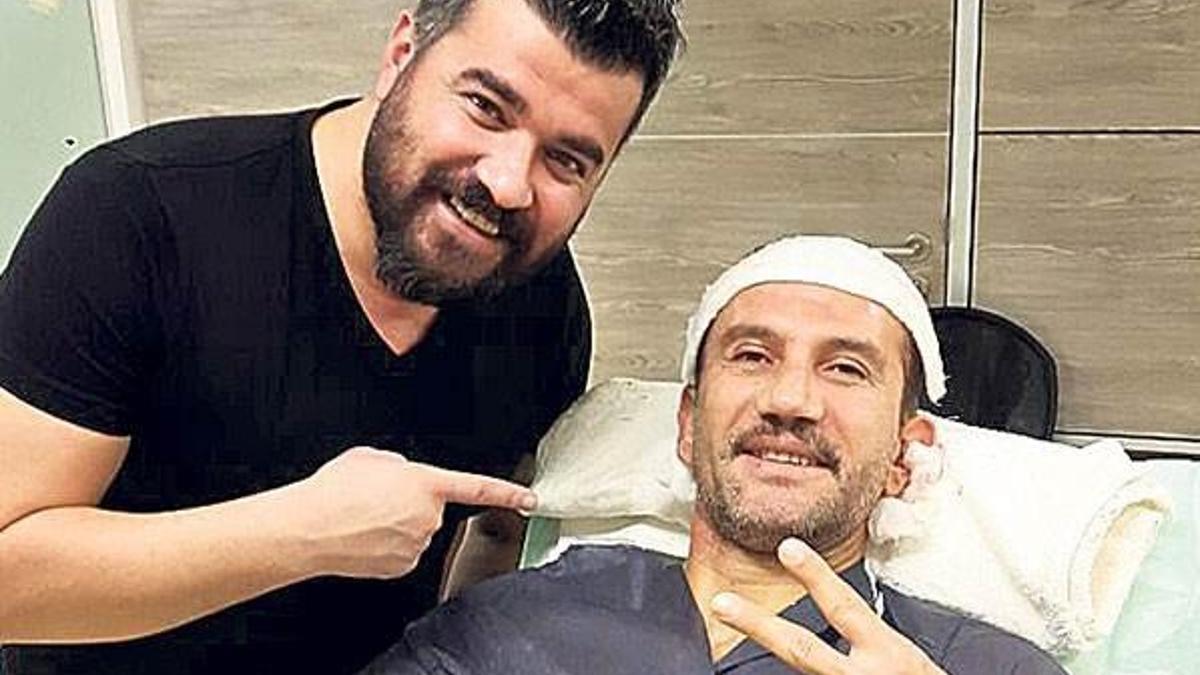 Saç ektirdi