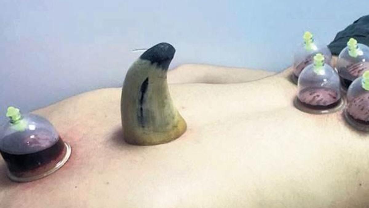 Bunu da gördük! İlk büyü bozma ve cin çıkarma hastanesi açıldı