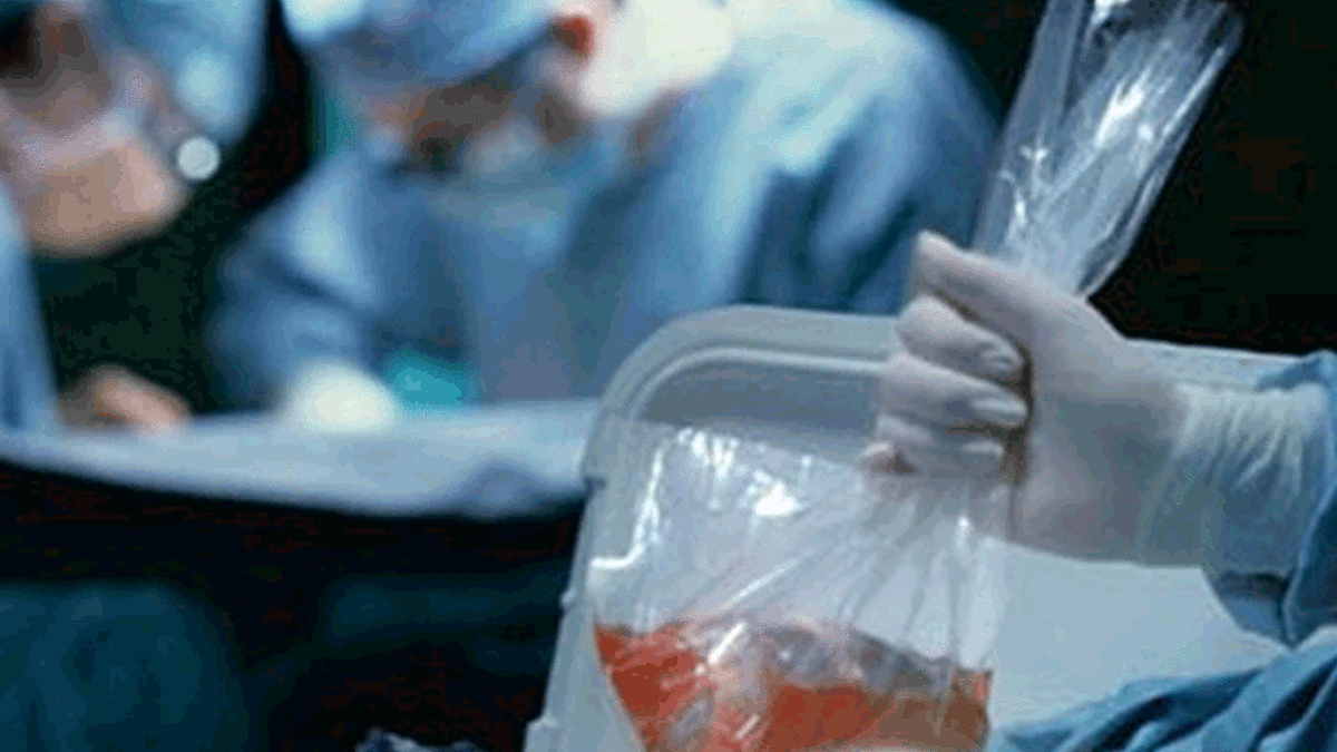 Organ bağışı uygulaması ülkeyi karıştırdı!