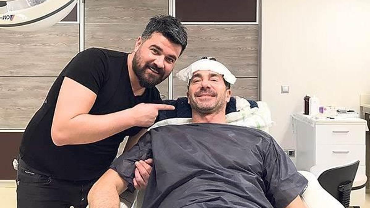 Saç ektirdi