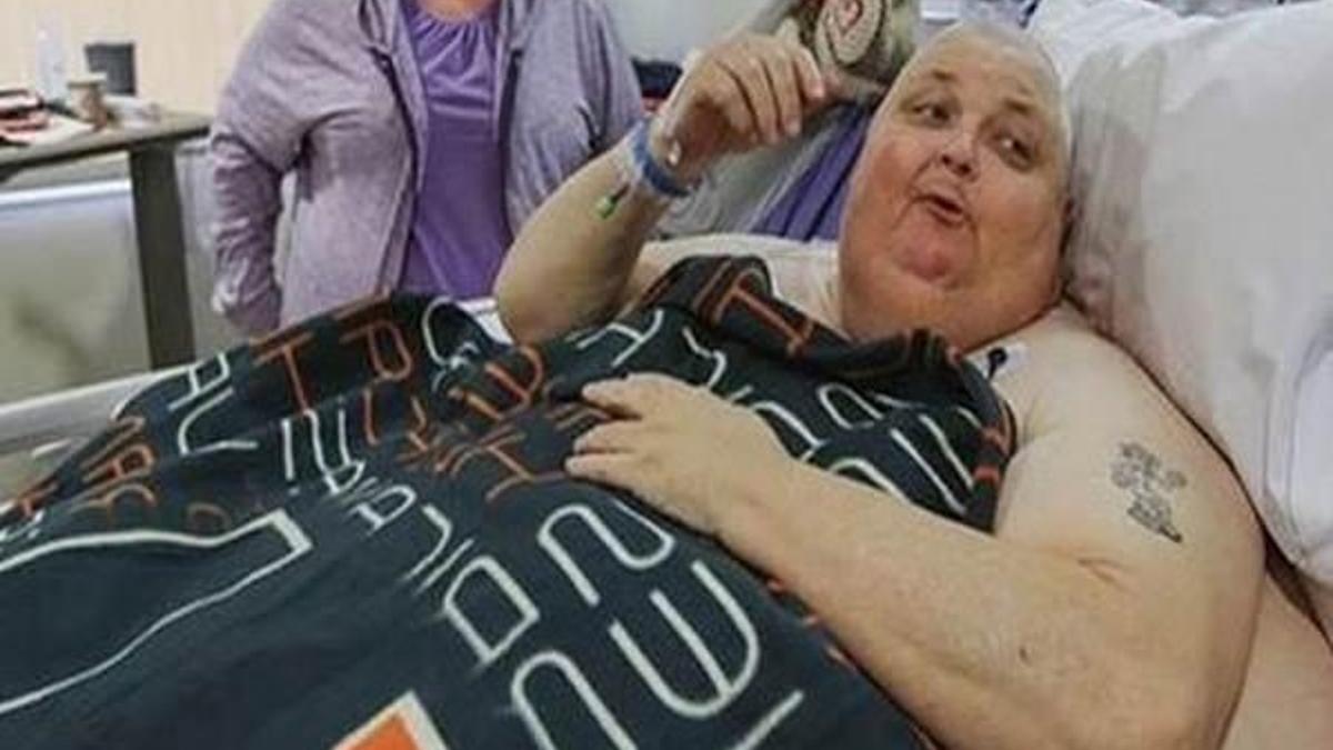Karnından 59 kilogramlık tümör çıktı!