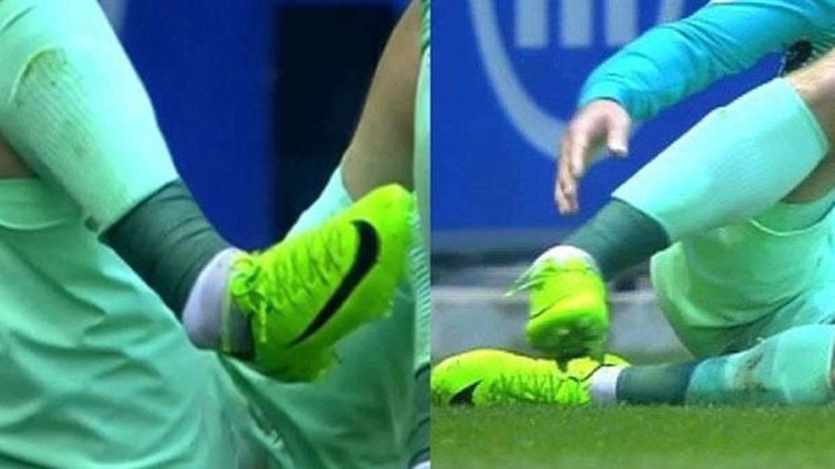 Barcelona'da şok! Ayağı kırıldı