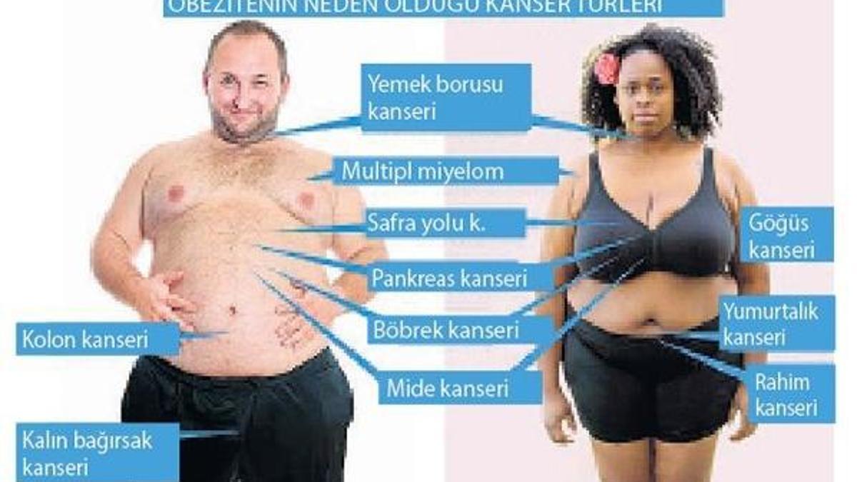 Obezite 11 kanser türü nedeni