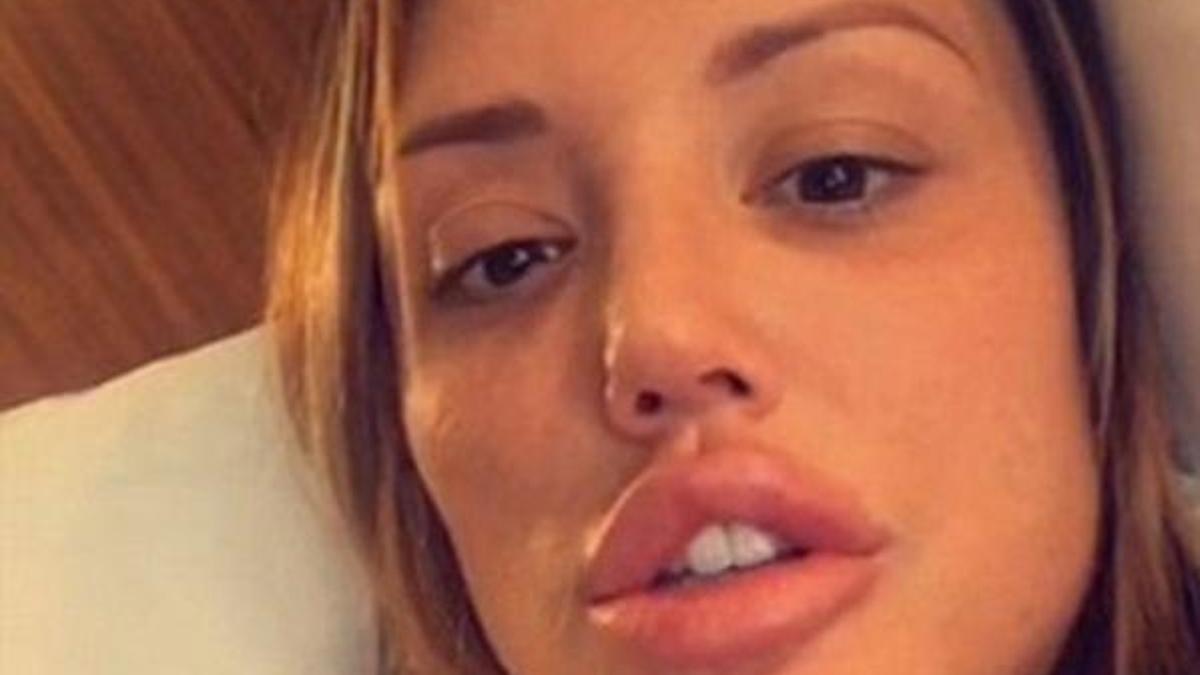 Charlotte Crosby'nin dudakları şoke etti!