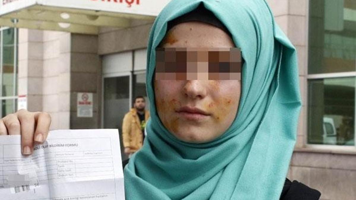 Liseli kızların tuvalet kavgası hastanede bitti